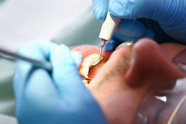 Best Urgent Tooth Repair  in Earlimart, CA